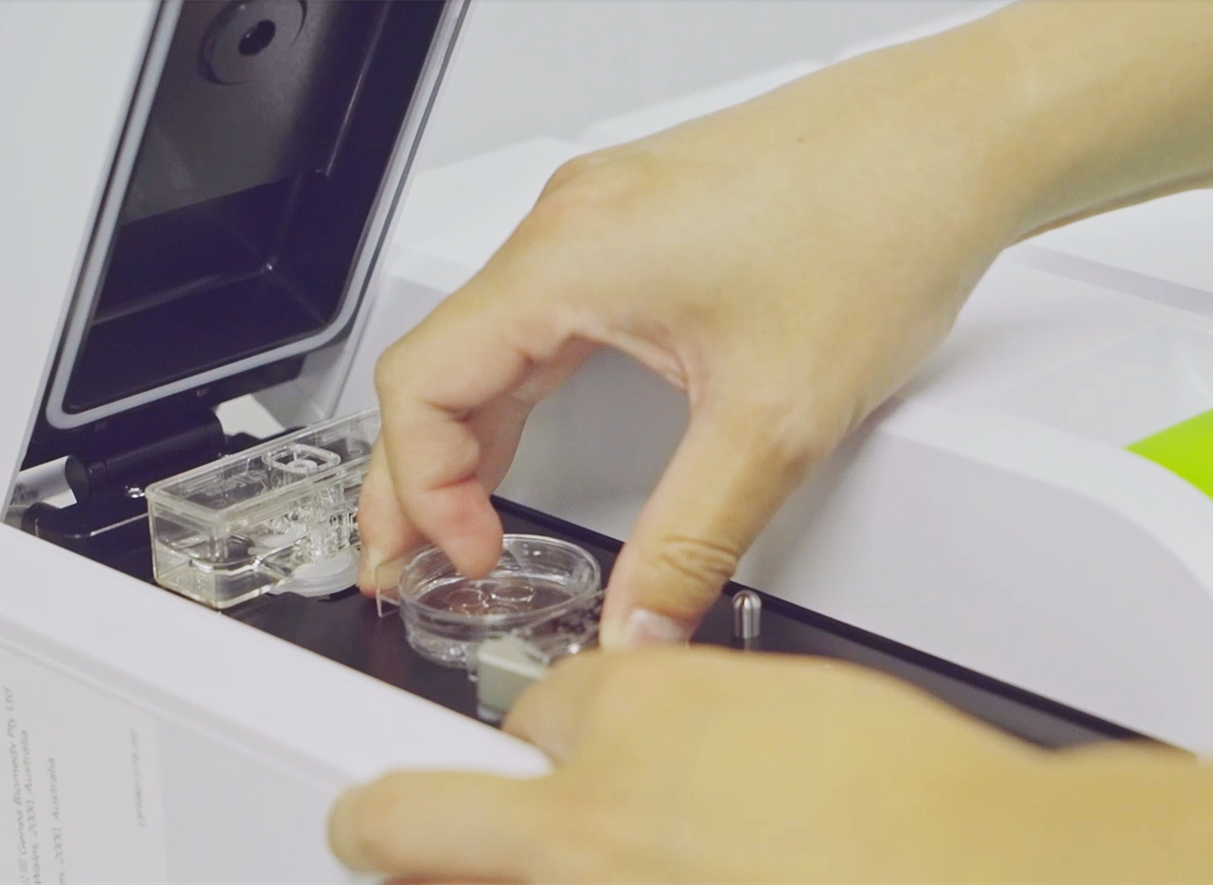 试管婴儿,试管妊娠率,影响试管成功因素