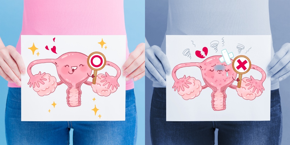 试管婴儿,试管准备,试管开始前的准备